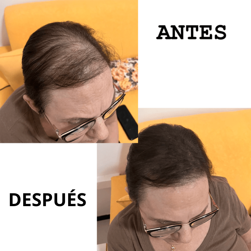 Polvo de Fibra Capilar Sevich - Fin de las Calvas en el Cabello